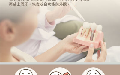🦷 植牙療程介紹｜重建咀嚼與笑容的關鍵治療