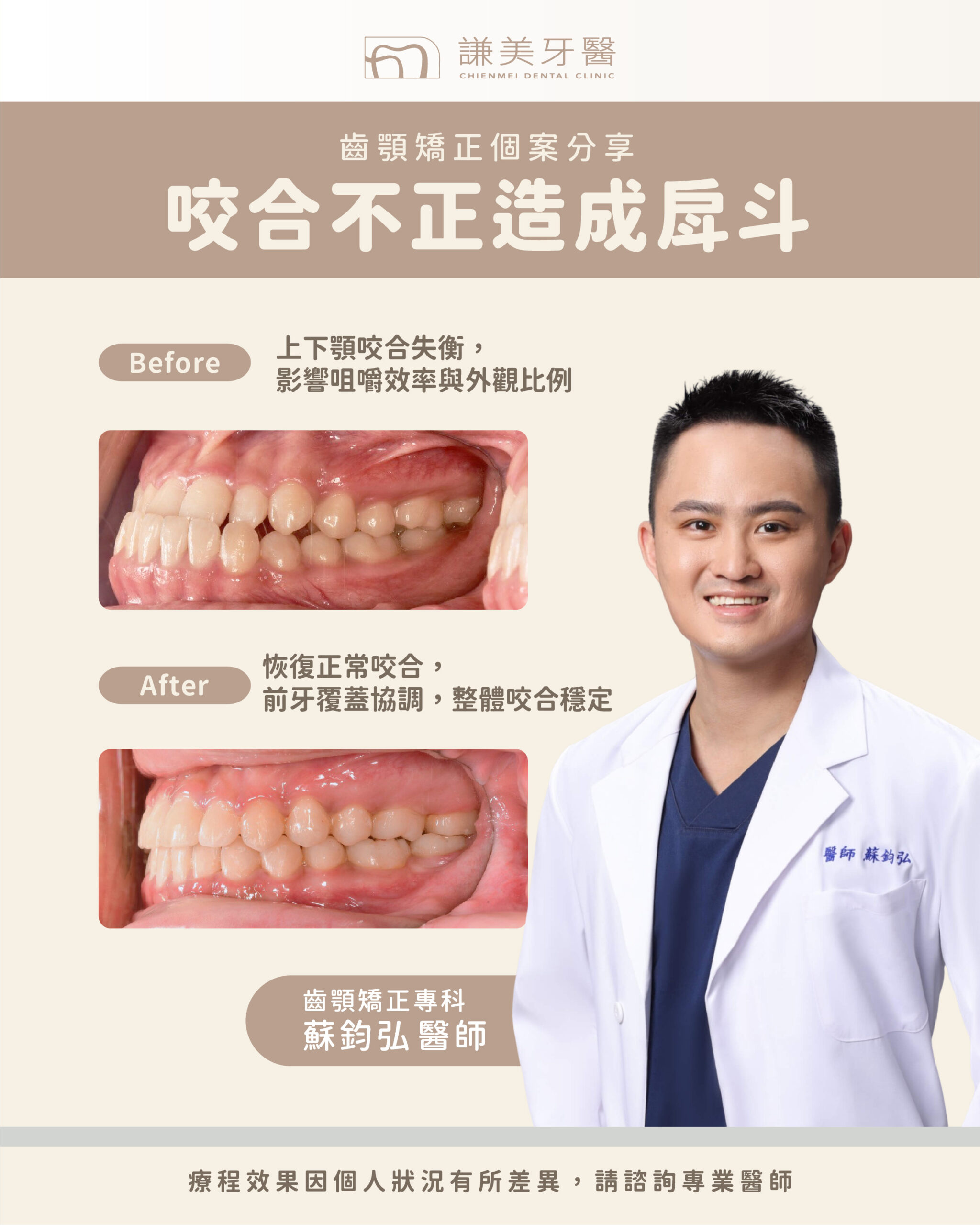 齒顎矯正案例_ 蘇鈞弘醫師-01