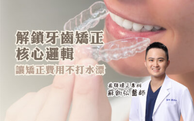 🦷 牙齒矯正這件事，大家都在比