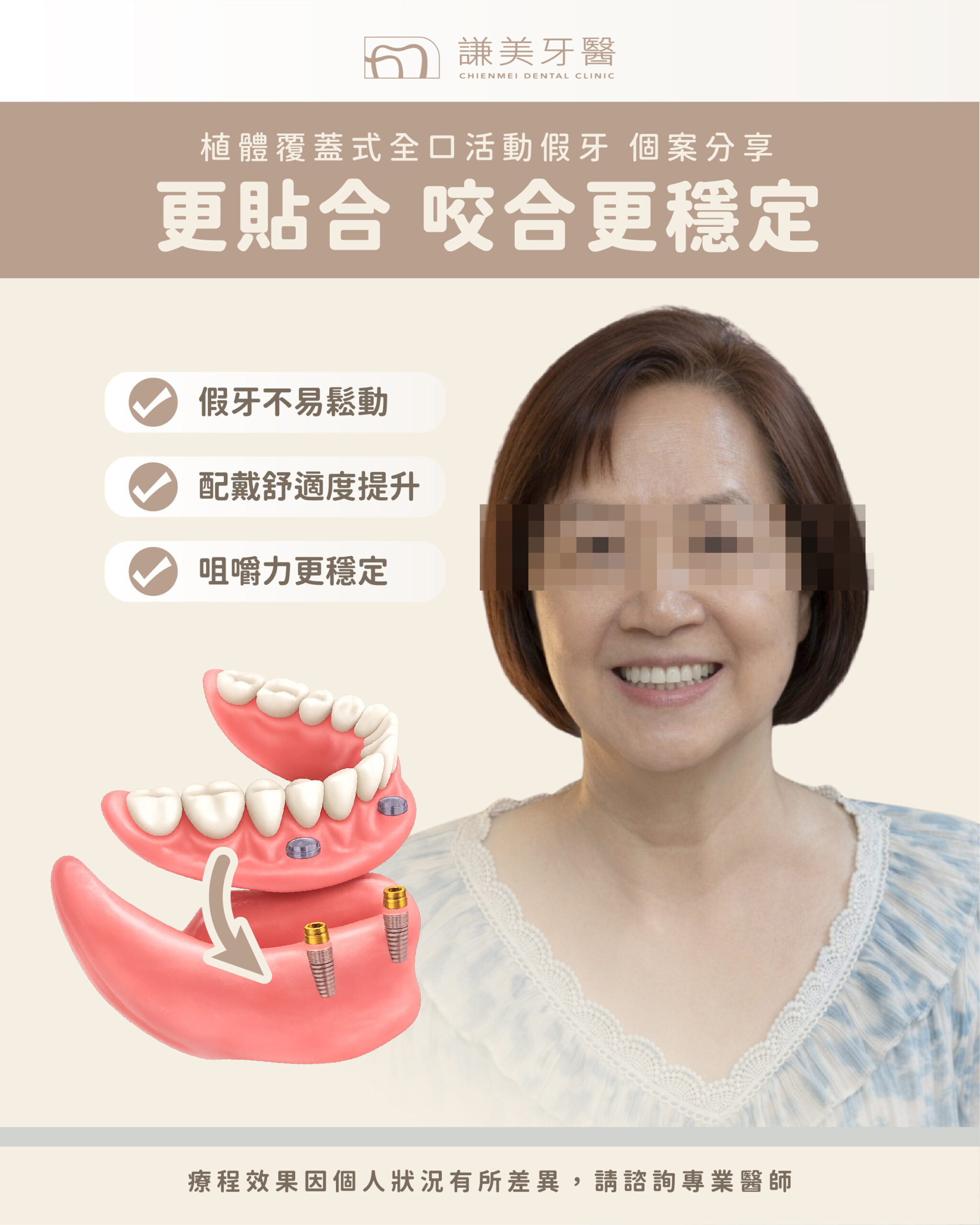阿姨_植體覆蓋式全口活動假牙_案例-01