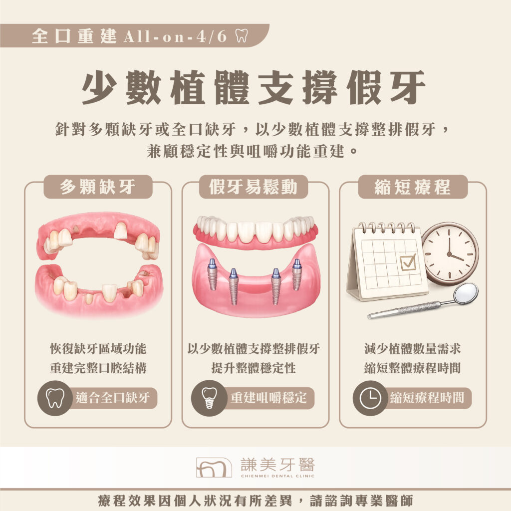 謙美牙醫診所「全口重建All-on-4/6」療程介紹✨ - 謙美牙醫診所｜三重