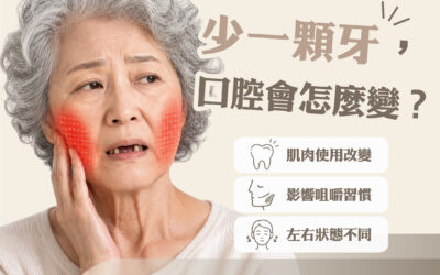 缺一顆牙會怎樣？缺牙可能影響咀嚼、牙齒排列與咬合